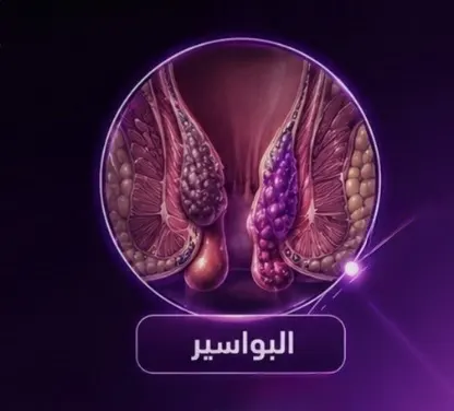 البواسير