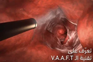 تقنية vaaft