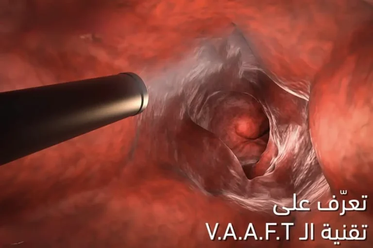 تقنية vaaft